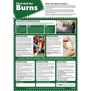First Aid for Burns Poster (Engelse versie)