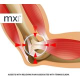 MX Health - Premium Neopreen Elleboogsteun - Zwart - Neopreen