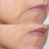 Perricone MD Cold Plasma Plus+ The Intensive Gel Mask Gezichtsmasker, 59 ml