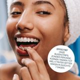 My White Secret - Whitening Strips - 14 Stuks - Veilig en Natuurlijke Samenstelling