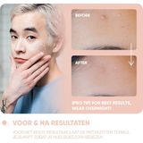 Breakout+Aid - Emergency Pimple Patch - 72 Stuks - Salicylzuur