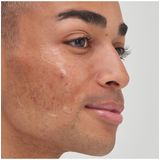 The Inkey List - Tranexamic Acid Serum - Huidverzorging - 30ml