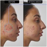 The INKEY List | Retinol 1% Serum | Supersolutions | 30ml