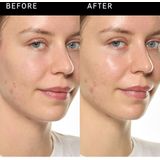 The Inkey List - Ectoin Hydro-Barrier Serum - 30 ml