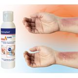 Detectaplast - Brandwondengel - 118ML
