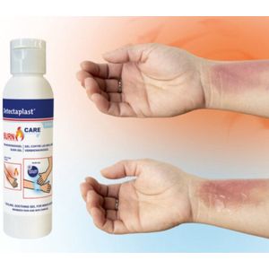 Detectaplast - Brandwondengel - 118ML