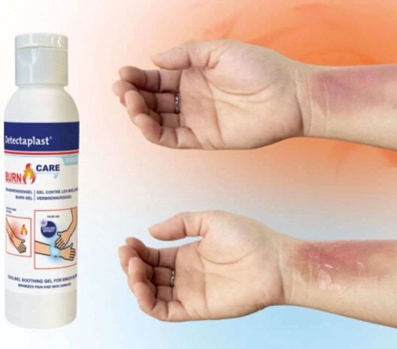 Detectaplast - Brandwondengel - 118ML