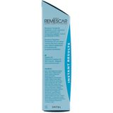 Remescar tegen Hangende Oogleden Tensor - Alternatief voor ooglidstickers en ooglidtape, Ooglidcorrectie via ooglid liftende crème, Anti Aging oogcreme, 8 ml voor maar liefst 160 applicaties