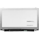 CoreParts - 15.6" LCD - FHD - Glanzend - Zwart - Wit