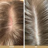 Australian - Hoofdhuidverzorging - 3 Producten - Tea Tree Olie - Serum 150ml - Shampoo 200ml - Conditioner 200ml