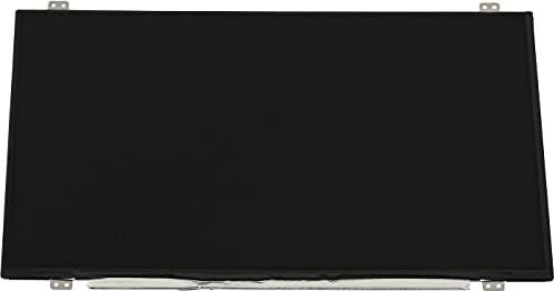 Lenovo 04X5880 laptop reserve-onderdeel Beeldscherm