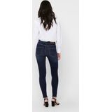 Only - Blush Life Mid Waist Skinny Ankle - Spijkerbroek - Rekbaar Materiaal