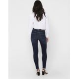 Only - Blush Life Mid Waist Skinny Ankle - Spijkerbroek - Rekbaar Materiaal