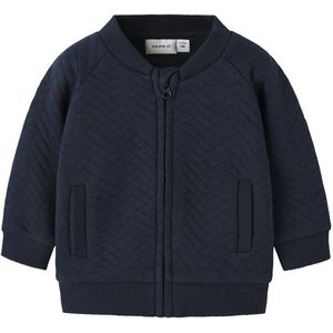 Name It - Vest - Katoen - Lange Mouwen - Ronde Hals - Knopen