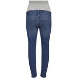 ONLY - OLMBILLY - Jeans - Slim Fit - Hoge Taille