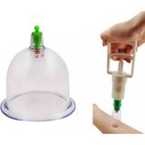 Soulima - Vacuum Cupping Set - 20-Delig - 6 Formaten Cups - Anti-Cellulitis Therapie