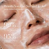 Gezichtscleansers - Cleansing Foam - 150ml