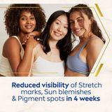 Nivea - Luminous Anti Marks & Spots - Lichaamscrème - 200ml - Hydraterend