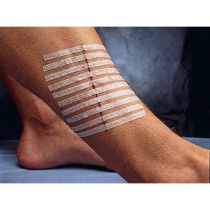 3M Steri-Strip Versterkte Huid Sluitingen, 3mm x 75mm, Pack van 10