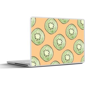 Laptop sticker - 17.3 inch - Kiwi's - Fruit - Patronen - 40x30cm - Laptopstickers - Laptop skin - Cover