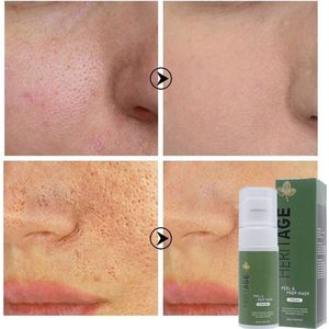 Peel & Prep pore minimizer mask - Dode cellen te verwijderen - Poriën te verkleinen - Remove dead cells mask