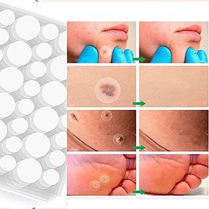 Wart Removal Patch om mollen eelt en platte hals wratten te verwijderen Facial Wart Remover Patch Cover en Verborgen Huid Label-Effectief en Scarless 108PCS