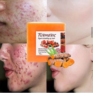 100% Natuurlijke kurkuma zeep| wonder zeep - 2 stuks turmeric soap| gezichtsreiniger| lichaamsreiniger| Helpt bij onzuiverheden zoals acne, zwarte poriën en pigmentvlekken| Body wash| hand wash| Zeepblok| handgemaakt turmeric soap