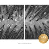 Moroccanoil - Scalp Purifying Scrub - 125 ml