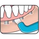 TePe Compact Tuft– Speciale tandenborstel