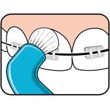 TePe Compact Tuft– Speciale tandenborstel