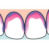 TePe Plaqsearch - Tandplakverklikker tabletten - 10 stuks