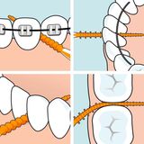 TePe EasyPick - Tandenstoker - Oranje - 36 Stuks