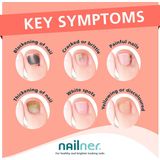 Nailner Active Red 30 ml + 8 ml