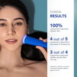 Foreo - Espada™ 2 - Gezichtsscrub - Cobalt Blue - Siliconen
