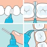 TePe Interdentale Ragers Original Groen ISO maat 5 – 0,8 mm (6 stuks)