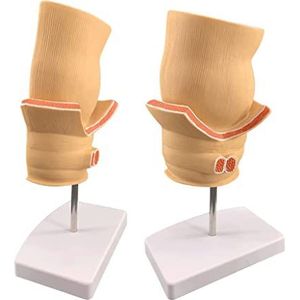 Anorectale Acne Pathologie Anatomisch Model Rectaal Pathologisch Model Medisch Onderwijs Aambeien Pathologie Model Orgaanmodel