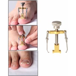 Happy Feets - Teennagel Corrector - Nagelknipper - Kalknagel