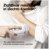 Braun - Silk-expert Pro 3 - Ontharingsapparaat - Wit - SensoAdapt™ Technologie