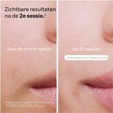 Braun - IPL Ontharingsapparaat Silk-expert Pro 5 - Ontharing Voor Thuis - Etui - PL5242