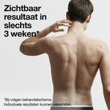 Braun - Silk-expert Pro 5 - Ontharingsapparaat - Inclusief Etui en Scheersysteem