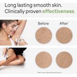 Braun - Silk-expert PRO 3 IPL3122 - Ontharingsapparaat - Wit - IPL