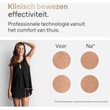 Braun - IPL Silk·expert Pro 5 - Ontharingsapparaat - Wit - 1 Hoofd