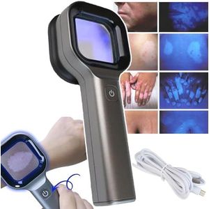 Draagbare Woods Lamp Skin Analyzer, Professionele Gezichtsvergrotende Analyser Voor Spa Salon Home Skin Care Machine, Vergrotingstijden: 2 Keer ± 20%, Bediening Met ééN Toets, Oplaadbaar