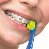 Curaprox | Ortho | Ultra Soft - 1 stuk