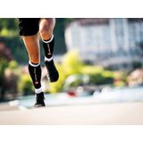 Compressport  R2 Calf Sleeves  Compressietubes  Black  T2