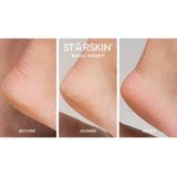 Starskin® Magic Hour Voetmasker - Eeltverwijderaars - Eeltsokken - Korean Skincare - 50ml