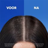 Head & Shoulders - Apple Fresh - Anti-roos Shampoo - Voordeelverpakking 6 x 285 ml