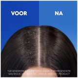 Head & Shoulders Anti-Haaruitval - Anti-roos shampoo - Tot 100% Roosvrij - Voordeelverpakking 6 x 285ml