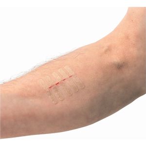 Huidhechtstrips 6x75mm - 150 Stuks - Sluiten van Kleine Snijwonden en Scheuren - Alternatief voor Hechtingen