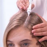 Revlon Professional - Restart Balance Clay Scalp Mask - 10 x 15 ml